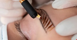 فیبروز ابرو چیست؟